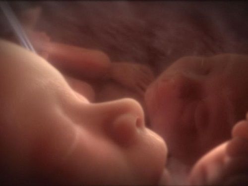 该专家称，孕妇的生活状态将影响胎儿的性取向。