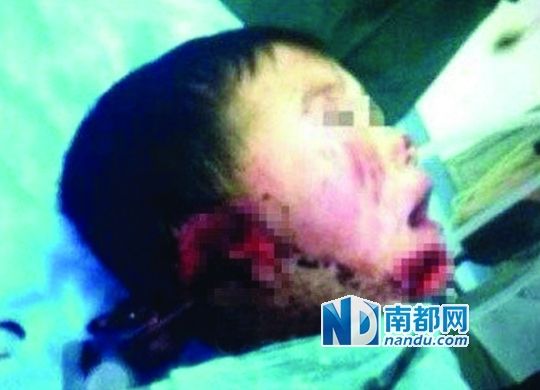  警方证实“幼童惨遭二妈割耳”一事。网络图片