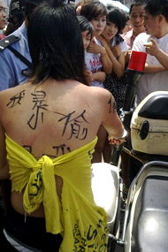 组图：海鲜过敏