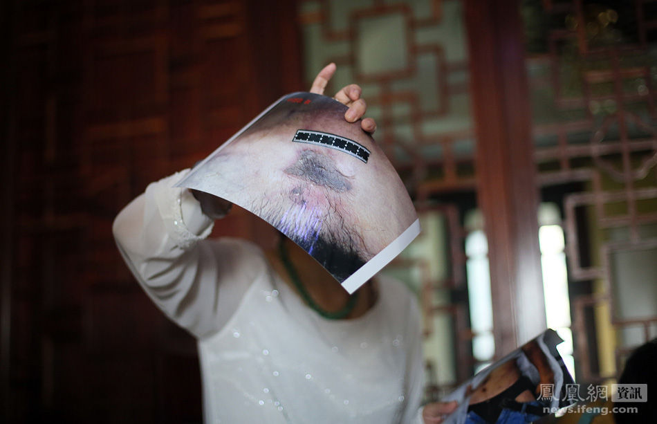 中国<em>首席女法医</em>王雪梅谈马跃之死_资讯频道