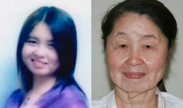 关注罕见病:80后<em>女孩儿分娩</em>后\一夜\变老