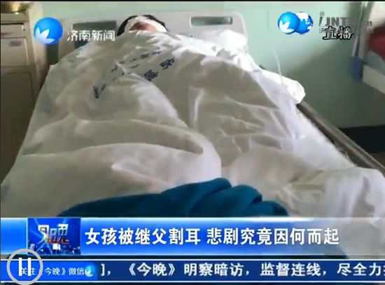 头部外伤包扎视频,头部外伤包扎视频图片,骨折外伤石膏纱布包扎视...