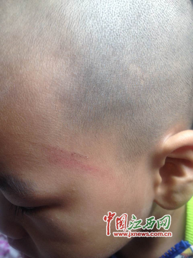 幼儿园老师用竹条打孩子 宜黄教育局:无证经营