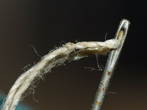 男子缝衣时睡着 绣花针钻进脖子长出鸡蛋大肿