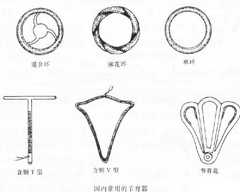 揭秘:女性私处上环避孕全程