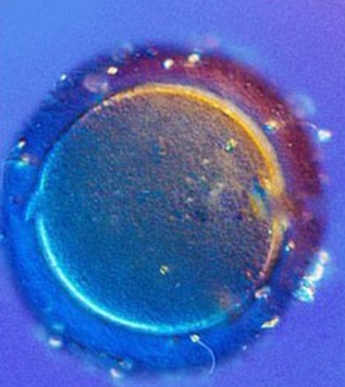 高清显微镜下:精子卵子相遇的神奇过程