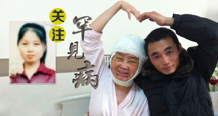 关注罕见病:<em>80后女孩儿</em>分娩后一夜变老-+白衣