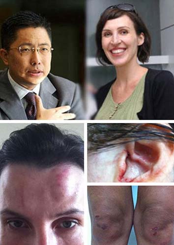  女白领家暴 博士 老公 :他不反抗我已打习惯 细数