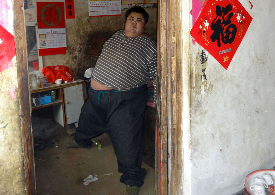 高清图—山东日照中国第一胖22岁600斤男子孙亮去世