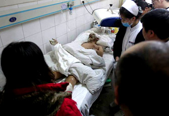 鞍钢喷爆事故受伤工人接受治疗