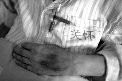 关怀病区病人在接受治疗。