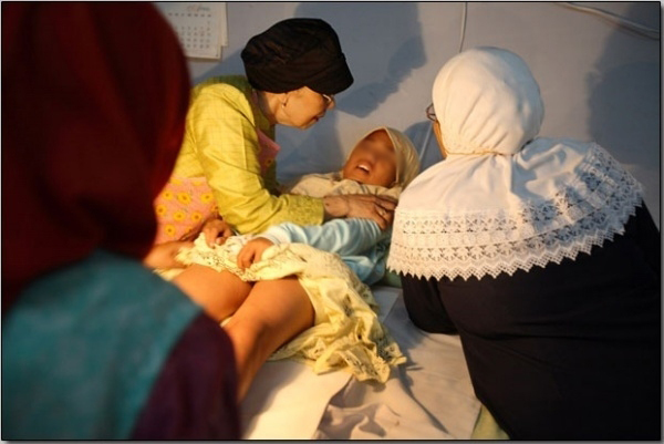 实拍印尼女孩割礼手术