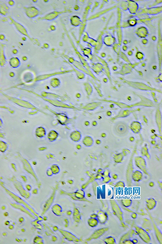 目前临床应用最广泛的细胞生物治疗是c ik细胞治疗,在显微镜下可