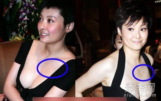 林志玲章子怡柳岩公众场合不穿胸罩裸露女星\/图|袁莉|演技_凤凰资讯