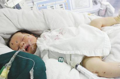 奇迹宝宝病情突变转院 不能落户漳州|货车|交