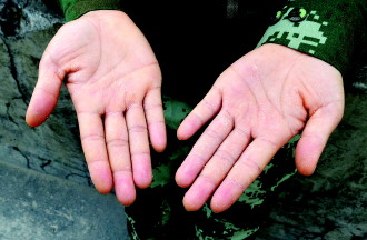 这是孙明静满是老茧和脱皮的手。由于长期翻查货物,女兵班成员原本细嫩的双手均出现脱皮现象。