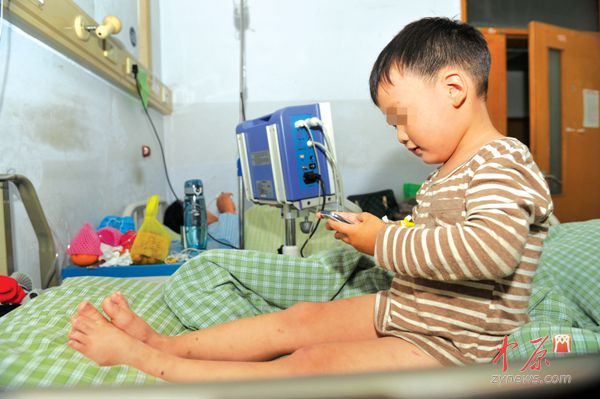 孩子在郑州中医院接受治疗。郑州晚报记者 张翼飞 图