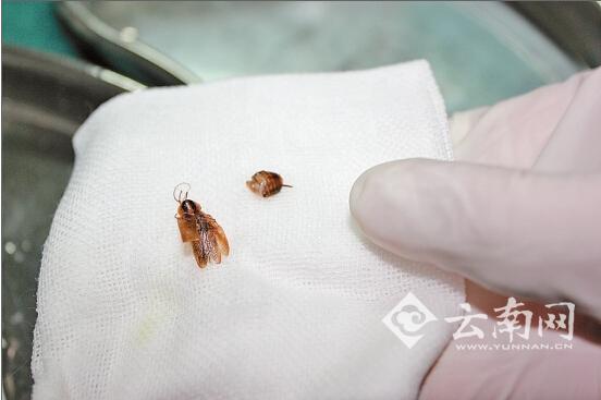 長(zhǎng)約2厘米的蜜蜂被取出