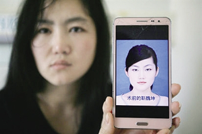 本想貌美如花 结果鼻歪脸斜