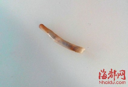 血管长得像虫子