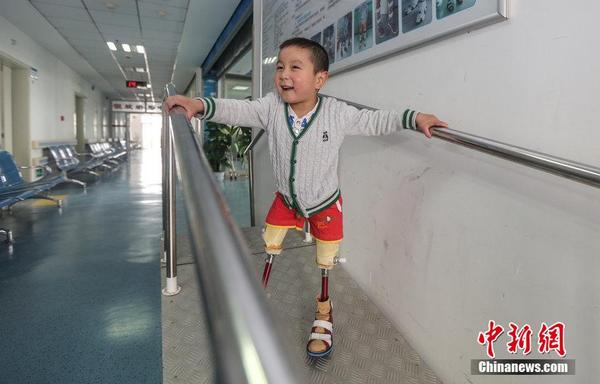 跳小苹果截肢男孩重新站立|苹果|截肢