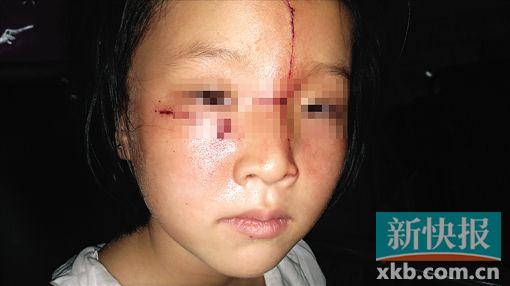 广州：7岁女童家门口惨遭陌生男割脸(图)