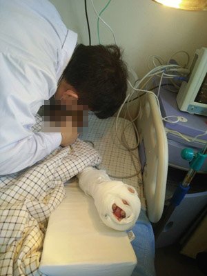 男童在医院接受治疗。家属供图