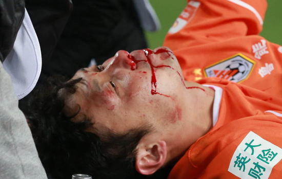 2015十大冲突:库卡裁判互殴 球迷被保安打吐血