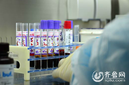 实验室中等待检测的血样，每个上面都标有编号。