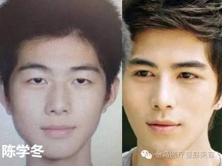 明星在哪整容,明星在哪整容比较好