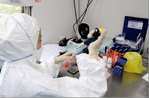 hiv核酸检测技术可提高公共用血安全