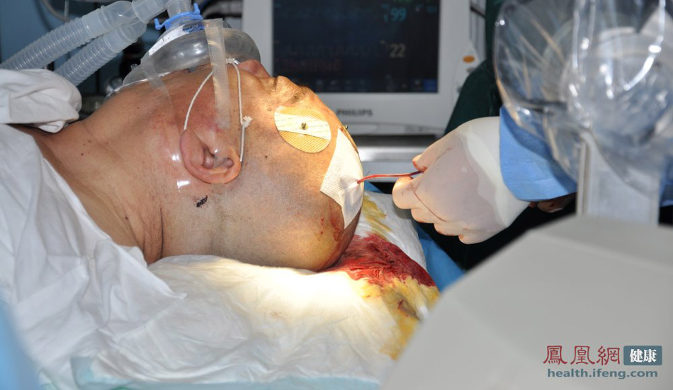 中国医院现场直击：记者实拍机器人脑定向手术全过程