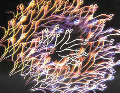 科学家发现X染色体神秘基因 或助制造精子