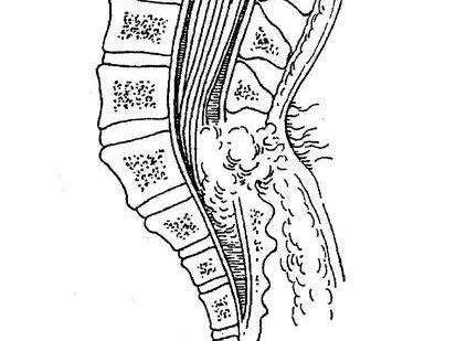 脊髓横切图手绘图