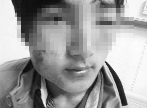 <em>初中</em>生<em>早恋</em>引发双方家长打斗致两败俱伤(图