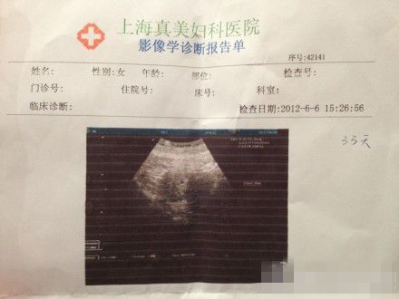 袁莉老公6月份曾晒出一张b超照(2/8张)   袁莉微博否认怀孕 遭恶意