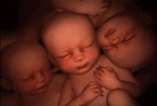 多胞胎在子宫内的发育照片(组图)