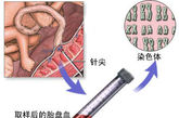 当血样抽取后，将被送到实验室进行检测。大多数情况下化验结果会在几周后得到。医生将根据实验结果给出是否终止妊娠的判断。
