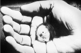 一个8周大的胎儿安眠在一只成人的手掌中，这是一次不幸流产的结果，但却给人们一个机会，可以清楚地目睹8周大的人类的真实模样。

