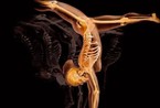 揭秘：孕妇和人体X射线艺术照