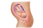 完美孕育全面解析：廿一周

胎儿已经21周了，这时他(她)的体重正在不断增加。这个小家伙现在看上去变得滑溜溜的，他(她)的身上覆盖了一层白色的、滑腻的物质，这就是胎脂。它可以保护胎儿的皮肤，以免在羊水的长期浸泡下受到损害。不少宝宝在出生时身上都还残留着这些白色的胎脂。

