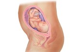 完美孕育全面解析：三十周

胎儿现在约重1500克左右，从头到脚长约44厘米。男孩的睾丸正在向阴囊下降，女孩的阴蒂已很明显。这时胎儿大脑的发育也非常迅速。几乎大多数胎儿此时对声音都有了反应。皮下脂肪继续增长。孕晚期胎儿的营养需求达到了最高峰，这时你需要摄入大量的蛋白质、维生素C、叶酸、B族维生素、铁质和钙质。

