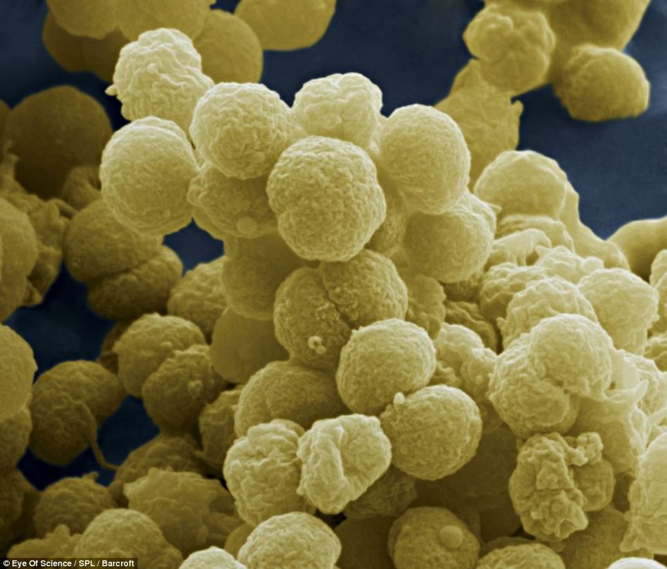 美国最近发生的病毒叫什么 xes_e9014b19d63515daefb9568dc74003c6.jpg