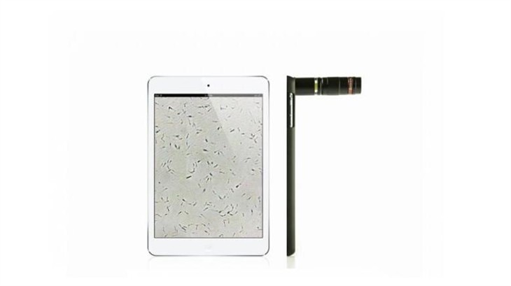 iPad又有新技能:通过显微镜头检测染色体