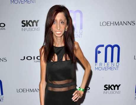 曾被嘲笑为"全世界最丑女人"的美国女子维拉斯克斯(lizzie velasquez)