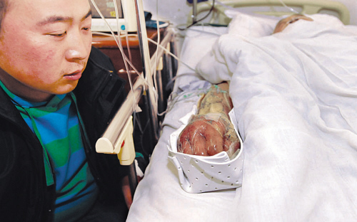 　　儿子小吕看着被人咬伤的父亲