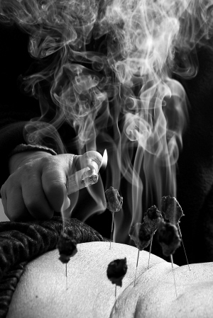 　　温针、艾灸是杨氏针灸的特色技能。本版图片 身体周刊记者 王辰