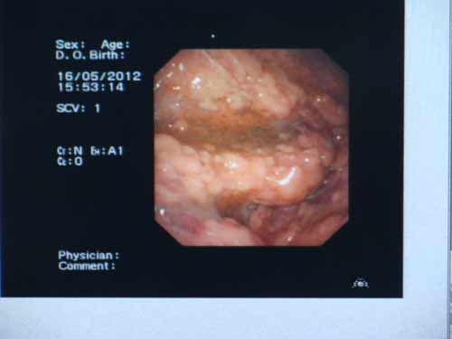 收入证明_呼吸科医生收入(2)