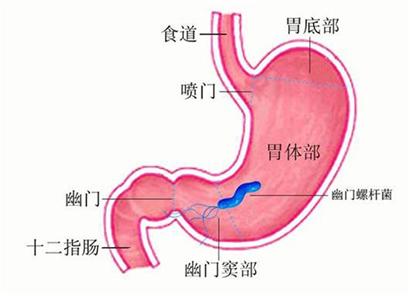 血糖不稳会连累到胃