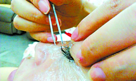 大花发箍豆豆鞋 扮美神器成祸源 美女头痛脚也